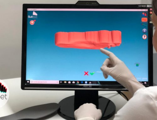 ¿Por qué utilizar un escáner 3D en tu clínica de podología?